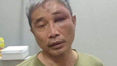 Foto Muhammad Kace Usai Dianiaya Irjen Napoleon Bonaparte: Mata Lebam