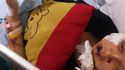 Geng Motor Berulah di Tangerang! Bocah Perempuan Dibacok, Polisi Kejar Pelaku