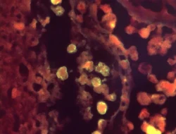 Warga Israel Tewas Terkena Infeksi “Amuba Pemakan Otak”